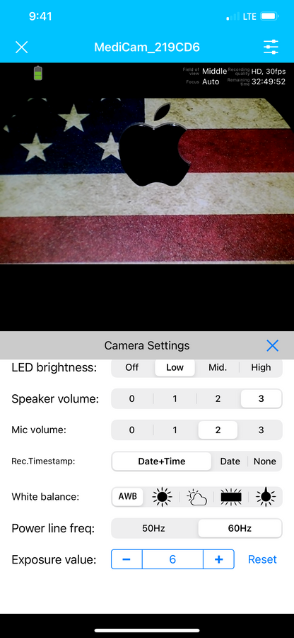 IC HeadCam 10K Lux LED Full-HD Dental Camera
