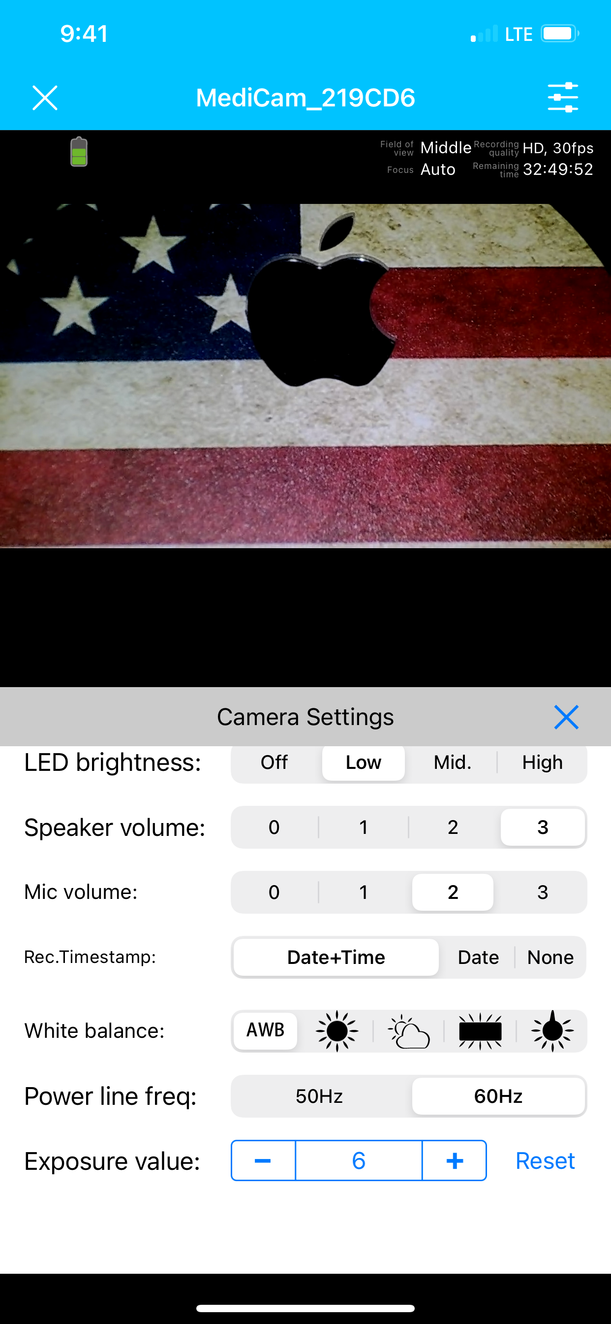 IC HeadCam 25K Lux LED Full-HD Dental Camera